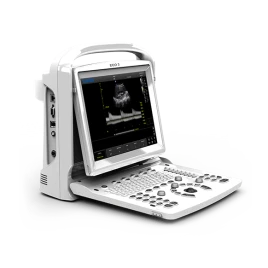 УЗИ аппарат CHISON ECO 3 Expert