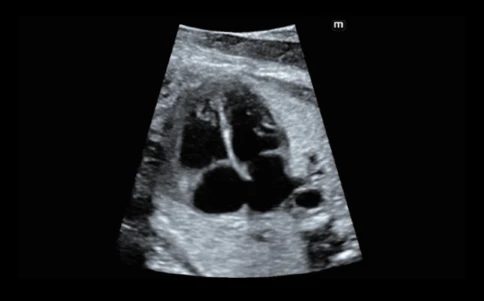 Ультразвуковой аппарат Mindray Imagyn I9 Easi фото 9