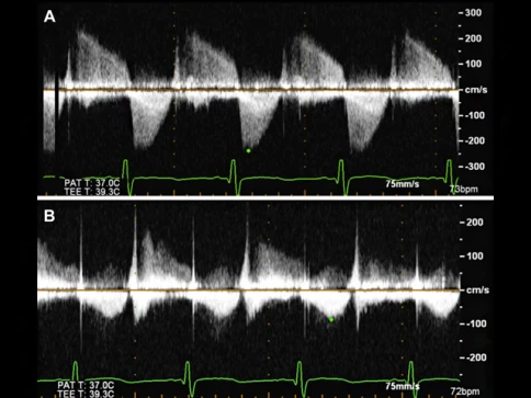 УЗИ аппарат Edan U50 Prime Edition фото 6