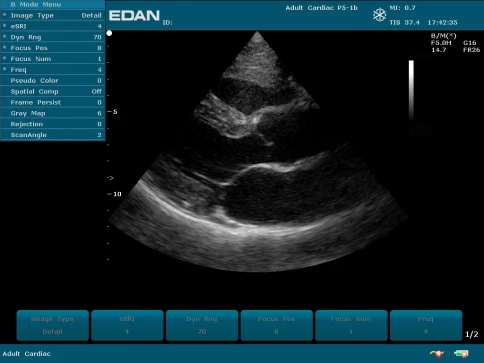 УЗИ аппарат Edan U50 Prime Edition фото 40