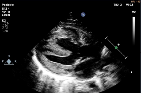 УЗИ аппарат Philips EPIQ CVx фото 7