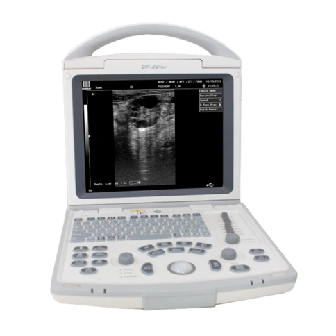 УЗИ система Mindray DP-20 фото 2