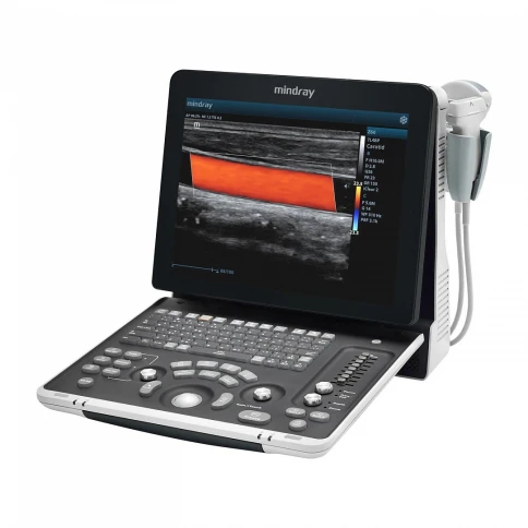 УЗИ сканер Mindray Z60 фото 1