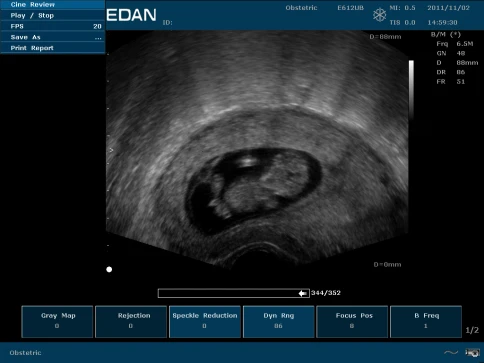 УЗИ аппарат Edan U50 Prime Edition фото 47