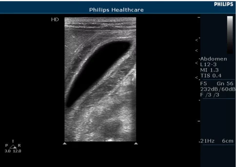 УЗИ аппарат Philips HD5 фото 4
