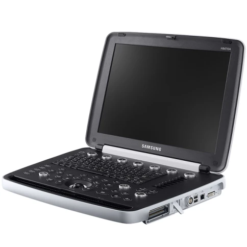Портативный УЗИ сканер Samsung HM70a фото 1