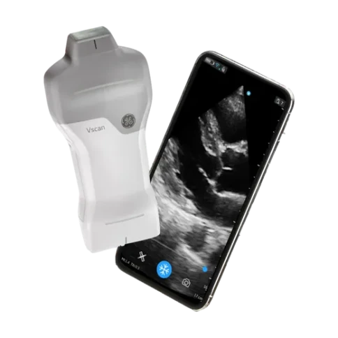 УЗИ аппарат GE HealthCare Vscan Air фото 4
