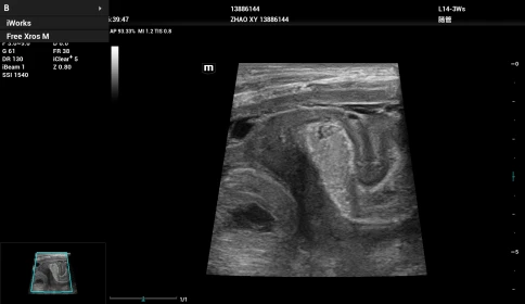 Ультразвуковой аппарат Mindray Resona I9 фото 18