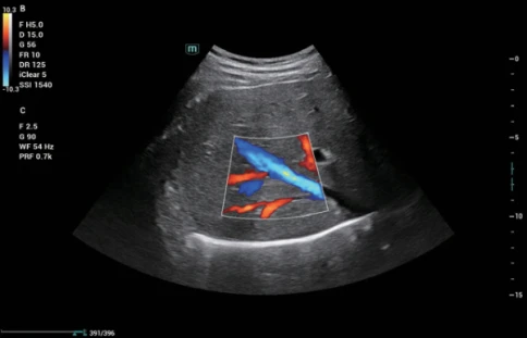 УЗИ аппарат Mindray Consona N6 фото 7