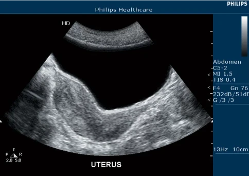 УЗИ аппарат Philips HD5 фото 10