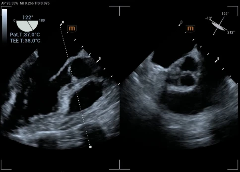 УЗИ аппарат Mindray Recho R9 фото 20