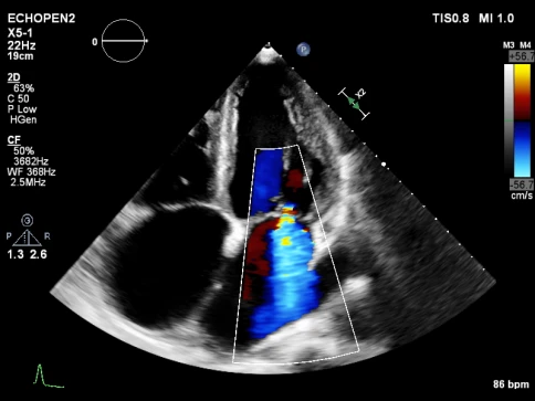 УЗИ аппарат Philips EPIQ CVx фото 8
