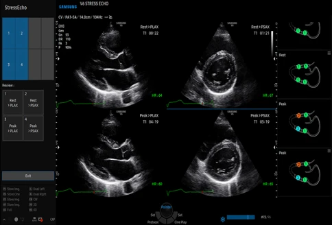 УЗИ аппарат Samsung V6 фото 17