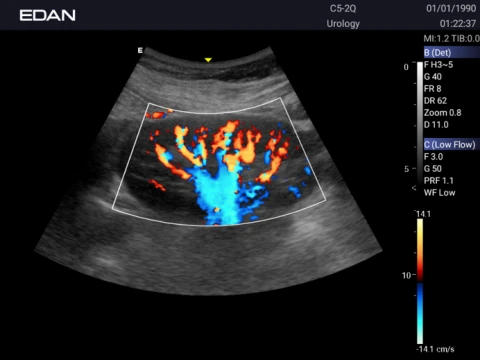 УЗИ аппарат Edan Acclarix AX3 фото 66
