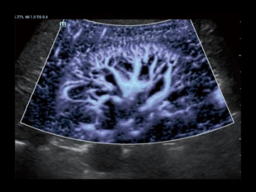 УЗИ аппарат Mindray Resona R9 фото 15