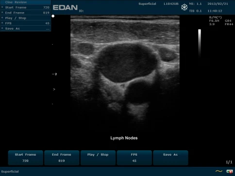 УЗИ аппарат Edan U50 Prime Edition фото 36
