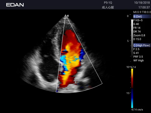 УЗИ аппарат Edan Acclarix AX3 фото 14