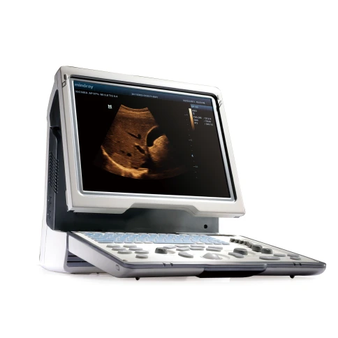 УЗИ аппарат Mindray DP-50 фото 6