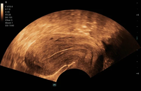 УЗИ аппарат Mindray Consona N6 фото 10