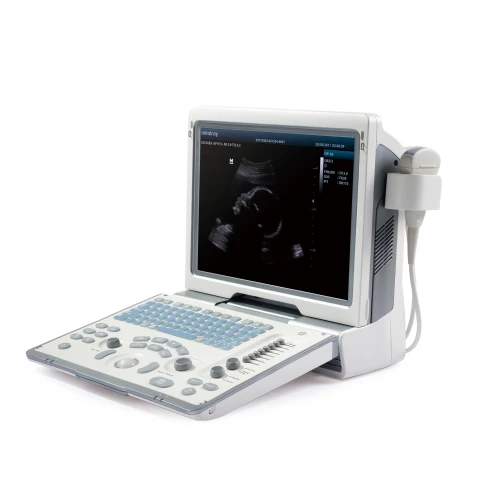 УЗИ аппарат Mindray DP-50 фото 1