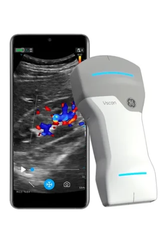 УЗИ аппарат GE HealthCare Vscan Air фото 3