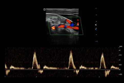 УЗИ аппарат SIUI Apogee 6500 фото 4