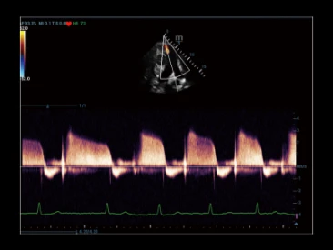 УЗИ аппарат Mindray Resona R9 фото 18
