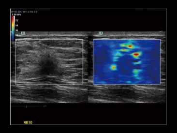 УЗИ аппарат Mindray Resona R9 фото 13