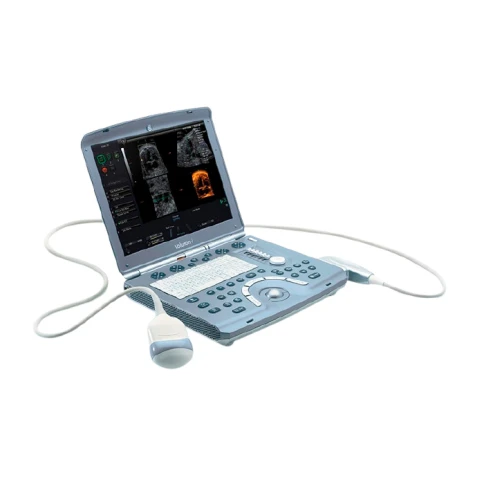 Портативный ультразвуковой сканер GE Healthcare Voluson I фото 4