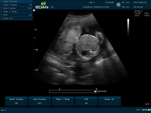 УЗИ аппарат Edan U50 Prime Edition фото 27