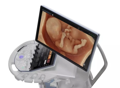 УЗИ аппарат GE HealthCare Voluson Expert 22 фото 3