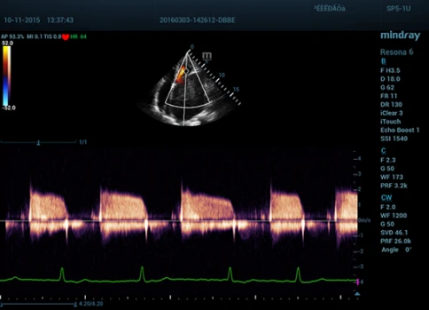 УЗИ аппарат Mindray Resona 6 Exp фото 14