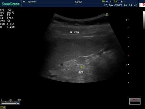 УЗИ аппарат SonoScape S40Exp фото 8