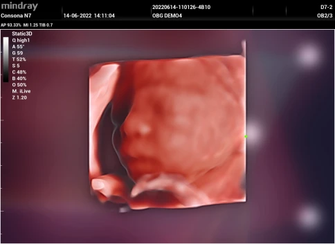 УЗИ аппарат Mindray Consona N7 фото 21