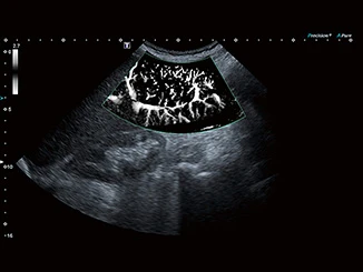 Ультразвуковой аппарат Canon Aplio a фото 4