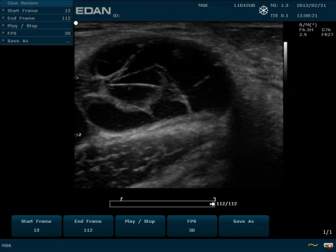 УЗИ аппарат Edan U50 Prime Edition фото 35