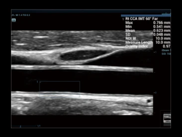 УЗИ аппарат Mindray Resona R9 фото 17
