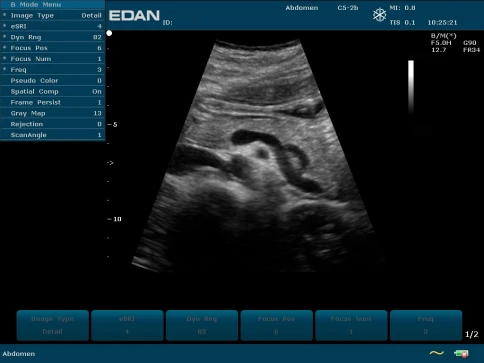УЗИ аппарат Edan U50 Prime Edition фото 18