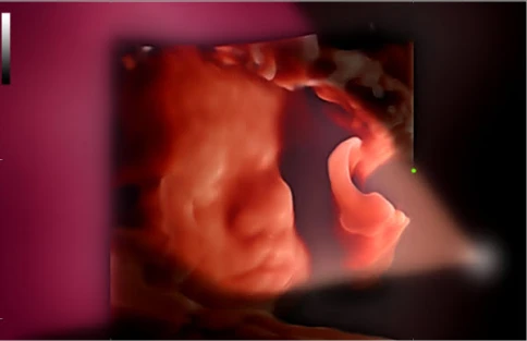 УЗИ аппарат Mindray Consona N8 фото 14