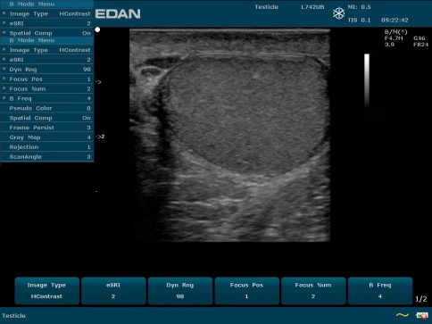 УЗИ аппарат Edan U50 Prime Edition фото 16