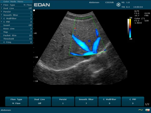 УЗИ аппарат Edan U50 Prime Edition фото 21