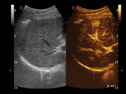 УЗИ аппарат Esaote MyLab Alpha фото 15