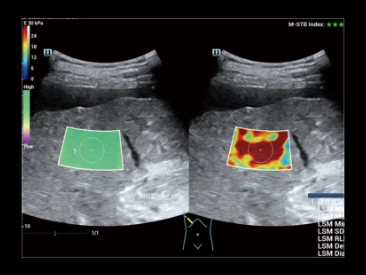 УЗИ аппарат Mindray Resona R9 фото 14