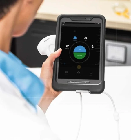 Мобильная ультразвуковая система Philips Lumify фото 4