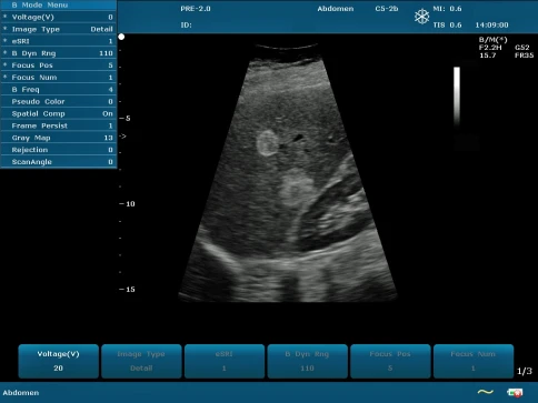 УЗИ аппарат Edan U50 Prime Edition фото 17