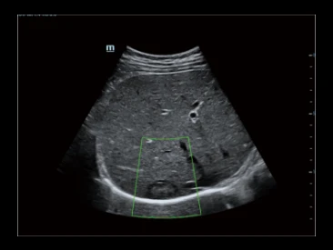 УЗИ аппарат Mindray Resona R9 фото 8