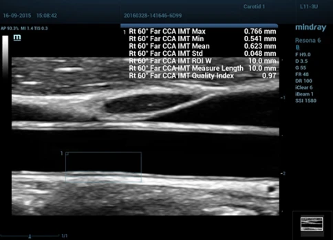 УЗИ аппарат Mindray Resona 6 Exp фото 12