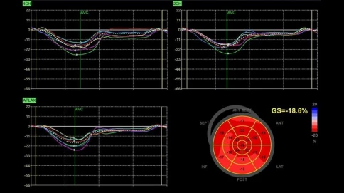 Ультразвуковая диагностическая система GE Healthcare Vivid T8 фото 7