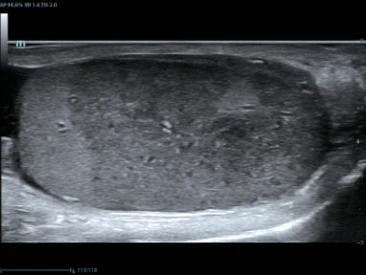 УЗИ аппарат Mindray DC-80 Exp X-Insight фото 12