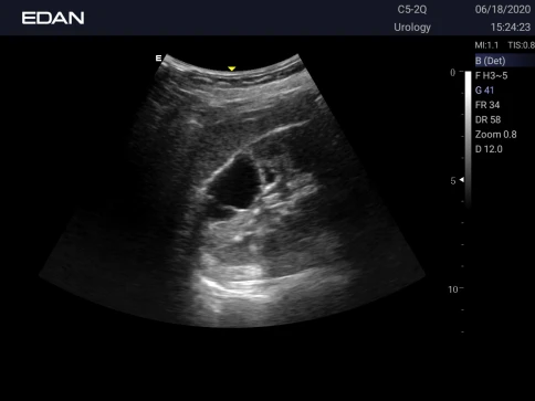 УЗИ аппарат Edan Acclarix AX3 фото 48